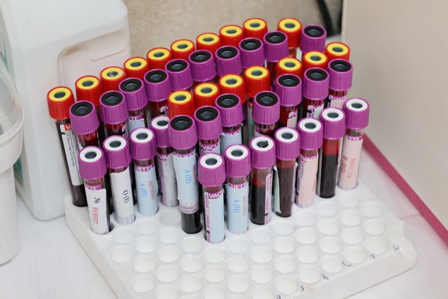 Blood sample tubes in a laboratory rack